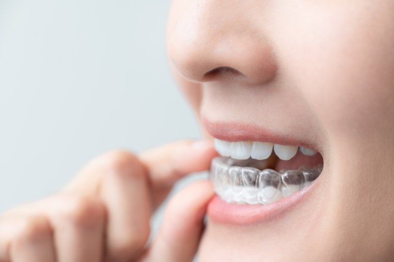 g/what-if-your-invisalign-aligner-doesn’t-fit
ALT image tag: